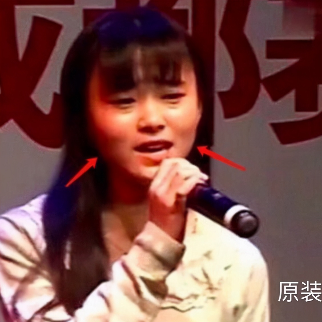 男生隆鼻很假,软骨隆鼻假吗