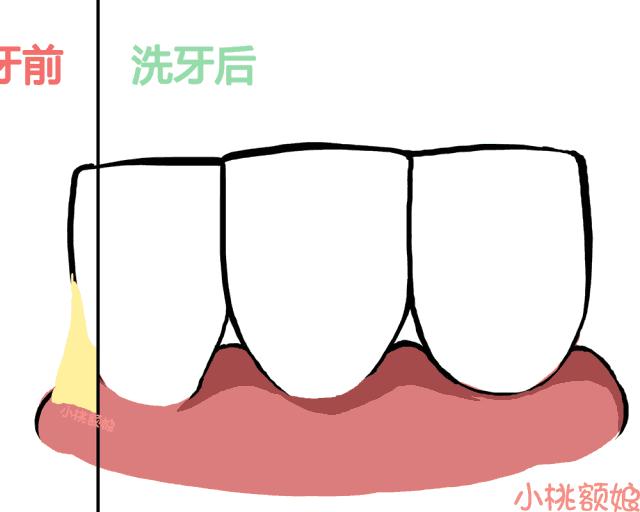 天天宅家胡吃海塞,水牙线比电动牙刷更靠谱!用过的都知道
