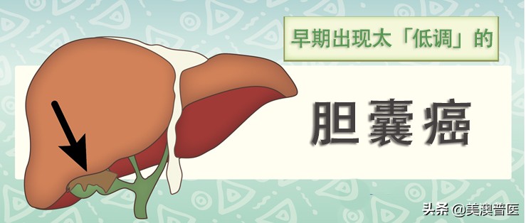 胆结石不治疗会拖成胆囊癌？有几点要特别注意