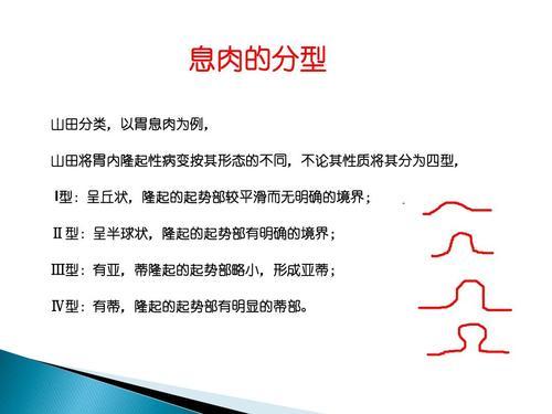 胃息肉该怎么治疗？