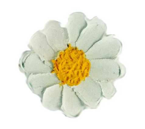 孕期超声检查是什么,准妈妈检查流程