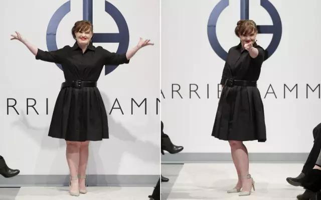 唐氏综合征中国美女,患有唐氏综合征的维密模特