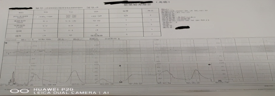 胎儿窘迫个案分享课件,胎儿窘迫案例分析题