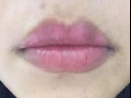 唇部纹绣后怎么护理,纹绣师自己漂唇第五天的效果