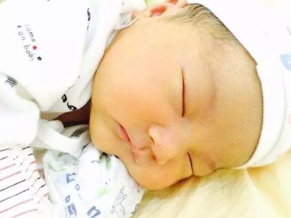 婴儿晒太阳去黄疸的正确方法,为什么婴儿黄疸晒太阳可以去除