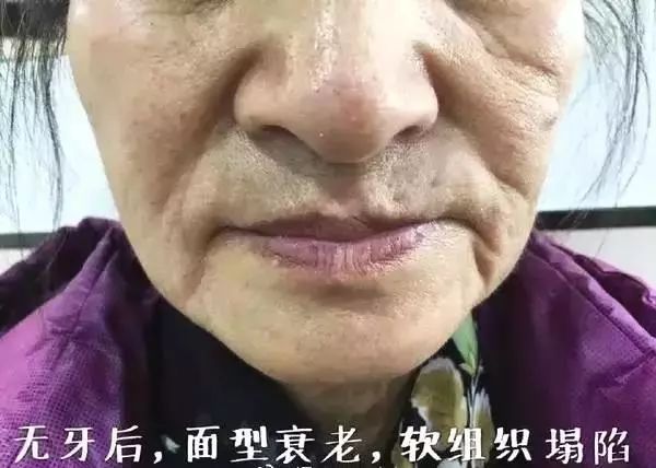 莆田系牙科坑人吗,莆田系口腔诊所曝光新闻