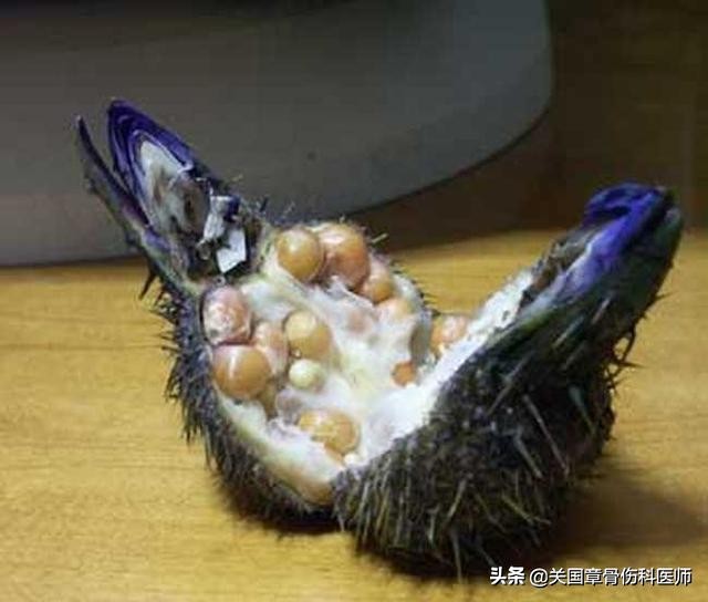 芡实枸杞人参泡水喝的功效与作用,芡实跟什么煮对脾胃好