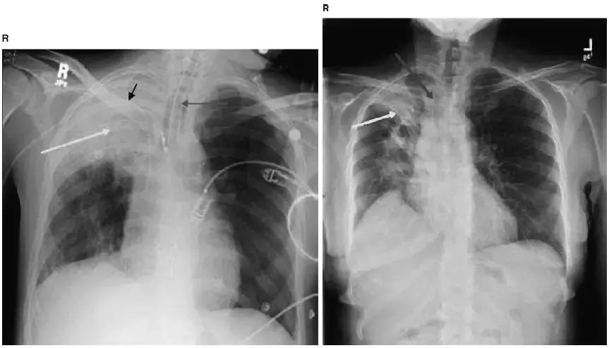 胸部影像解剖图谱书,胸部断层图谱