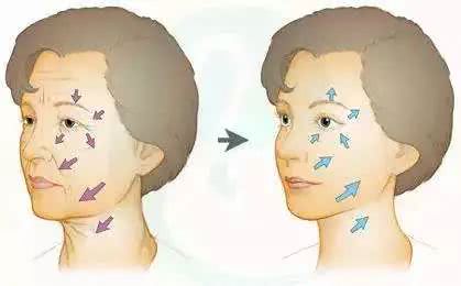 微整的真实效果,微整蜕变过程