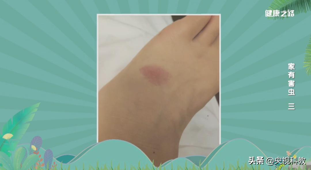 科学除四害视频,科学除掉蚂蚁