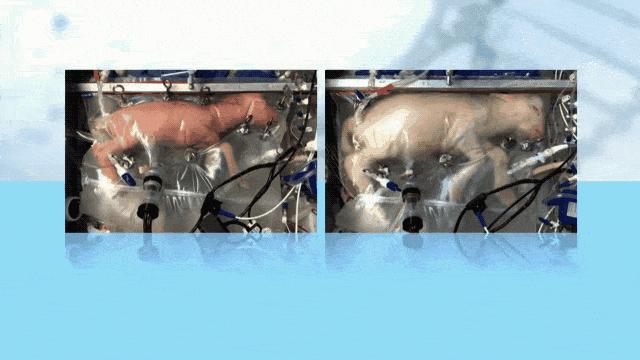 现在人造子宫成熟了吗,人造子宫是否会在2025年成功