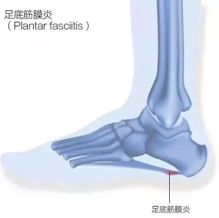 跑步新手应该了解的运动知识,跑步运动基础知识