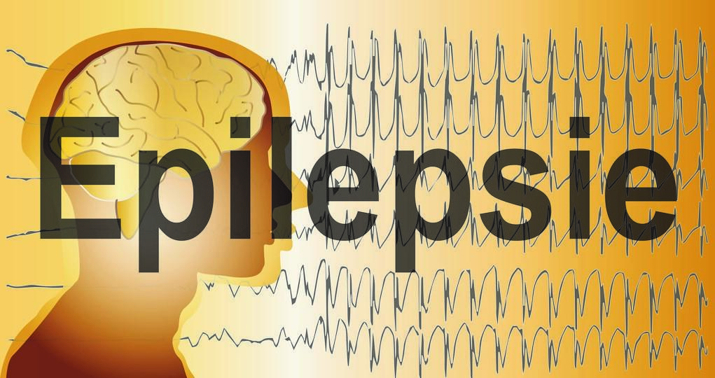 身边有人癫痫后的急救措施,身边有癫痫的人