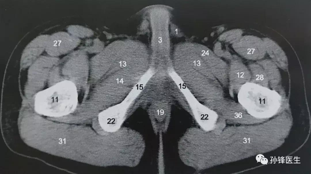 医学笔记︱男性会阴部的肌肉系统(中肛管水平):(下)