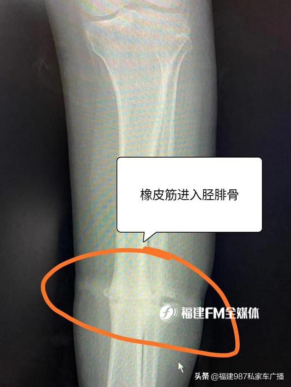 福建省级机关医院二甲,福建省级机关医院有哪些