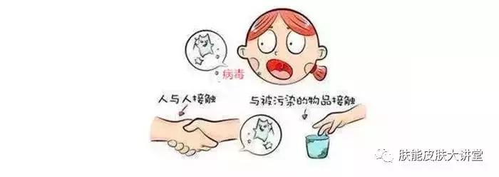 传染性软疣为何叫水瘊子,水瘊子和传染性软疣一样吗