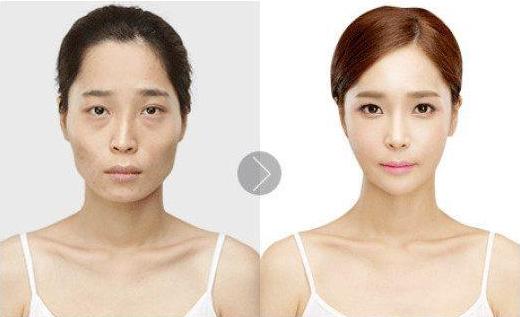 面部饱满是什么样的,面部窄才会面部饱满吗