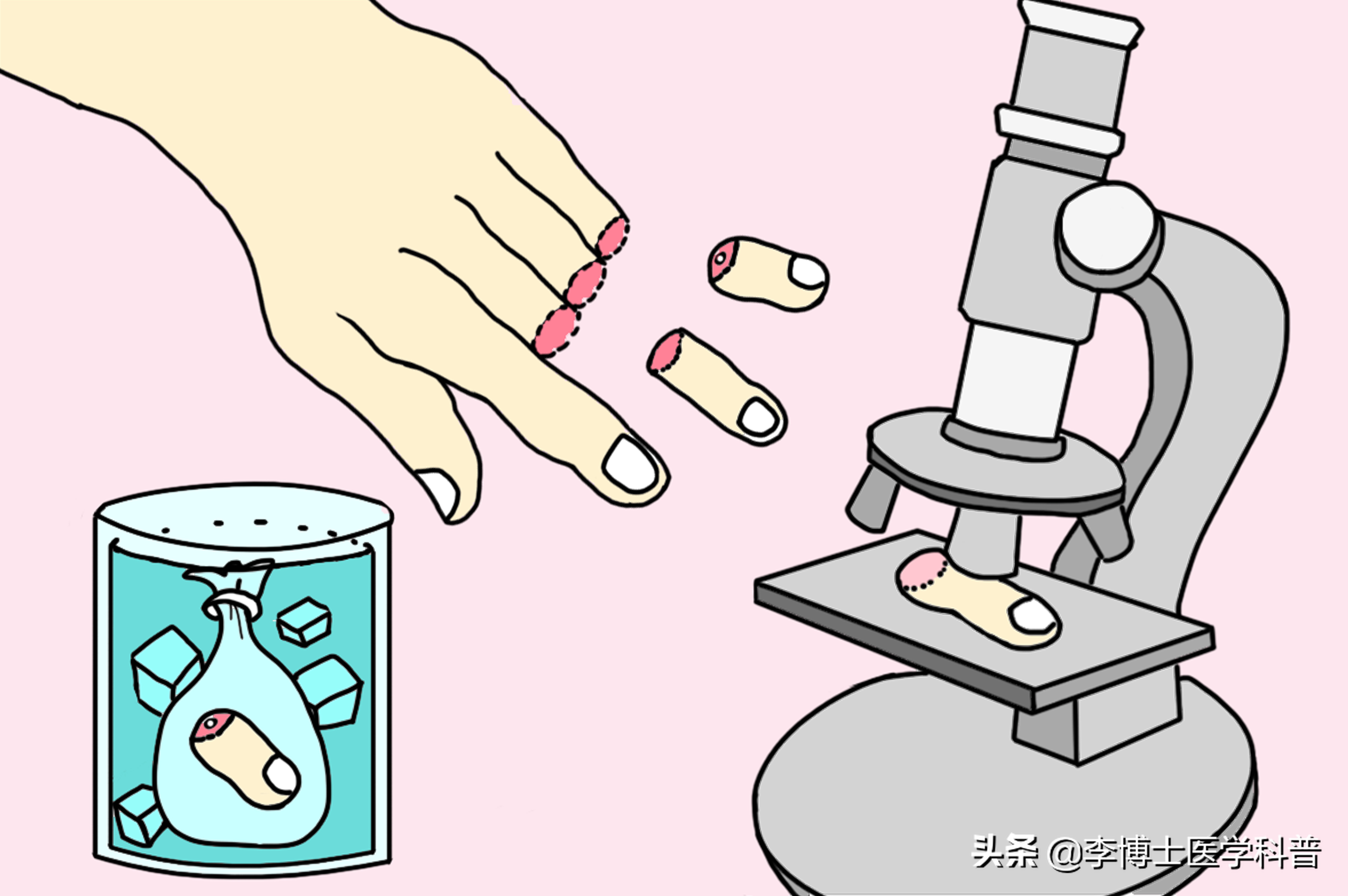 手部外伤急救,手部外伤家庭急救手抄报