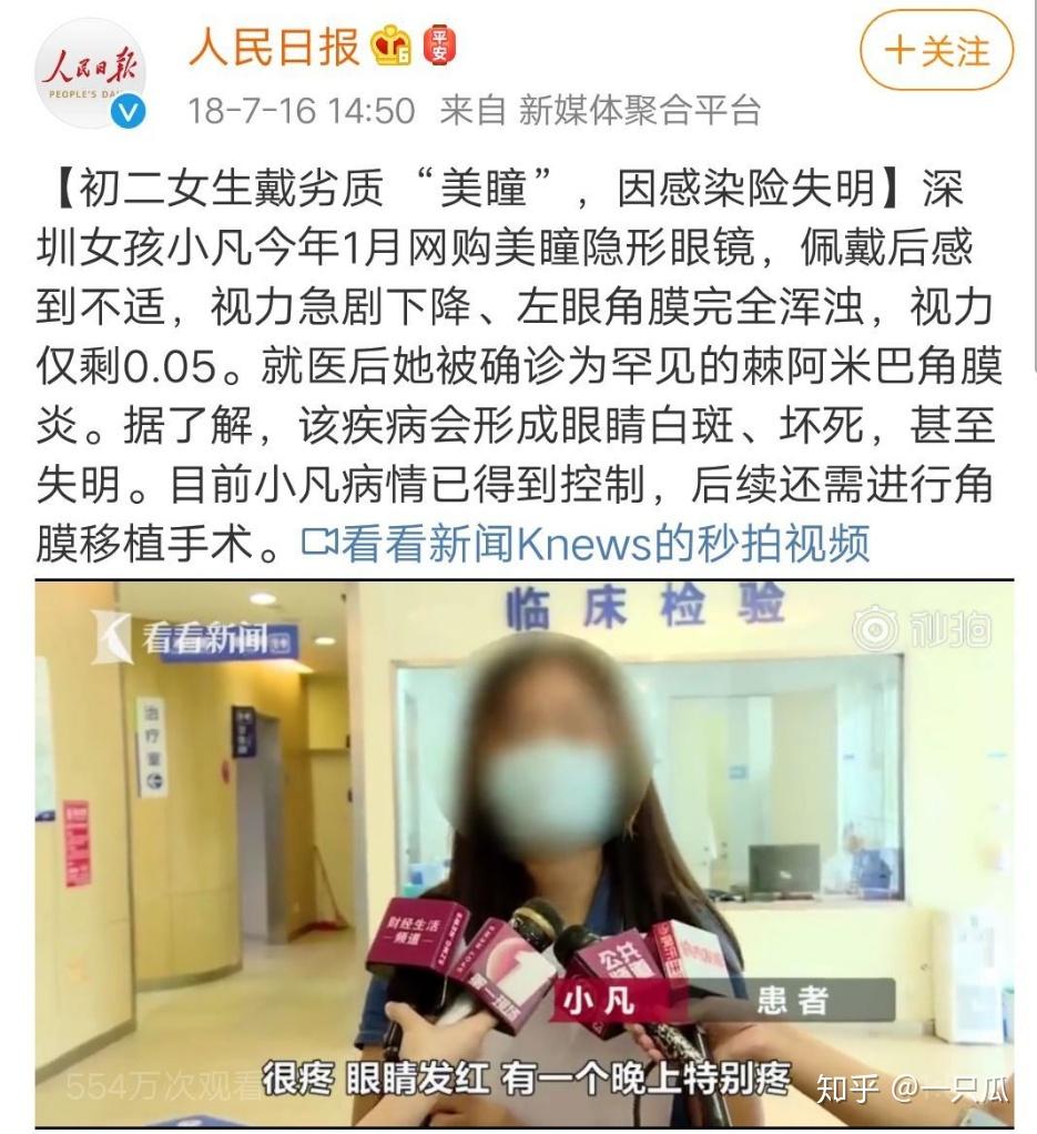 戴美瞳和不戴美瞳的区别,戴美瞳眼睛会不会无神