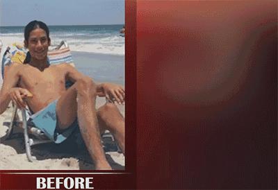 关于隆胸手术你想知道的那些事,隆胸丰臀整形