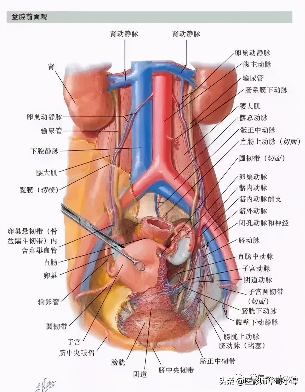 女性盆腔核磁解剖图谱,正常盆腔ct解剖图谱