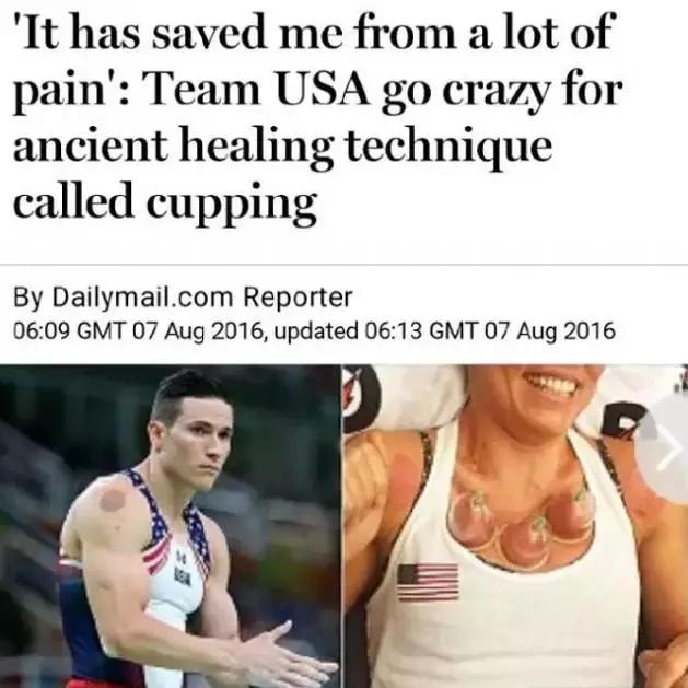 蚊帐成天价抢手货,拔罐变灵丹妙药,在外国人眼里,中国这么牛