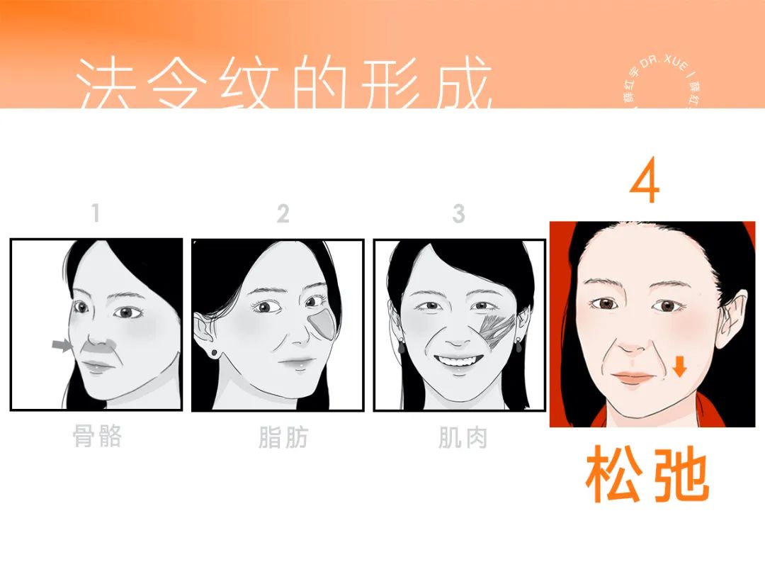 脾胃好了法令纹会改善吗,面部瑜伽能改善法令纹吗