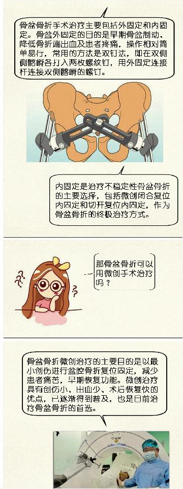 骨科髋部骨折科普视频,骨科大咖髋部骨折科普视频