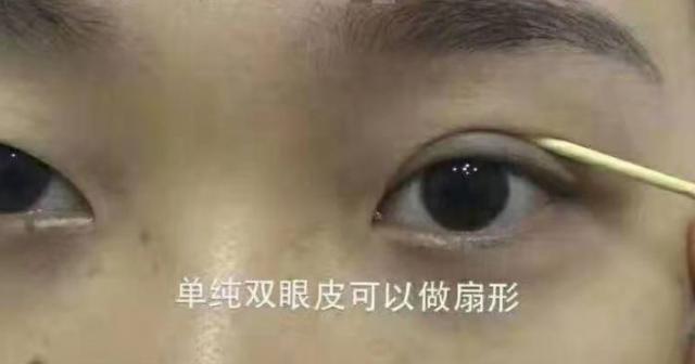 原来双眼皮不好看有必要继续割吗,双眼皮越看越奇怪怎么办
