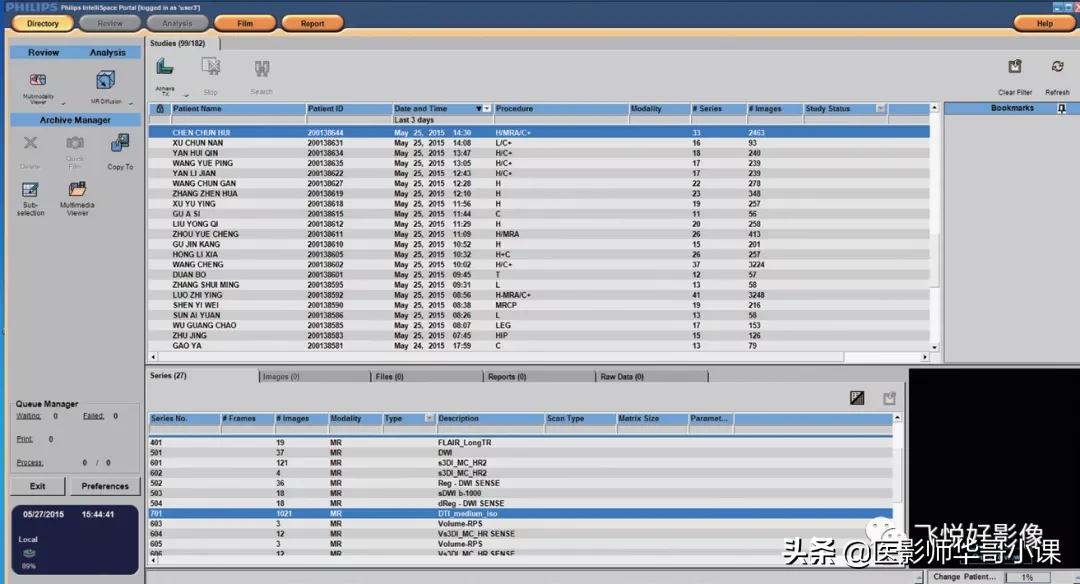 飞利浦磁共振波谱成像扫描技术,飞利浦磁共振纵隔扫描技术