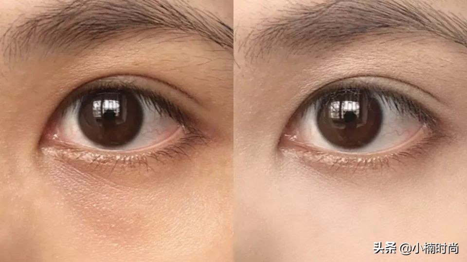 黑眼圈泪沟遮瑕手法,黑眼圈泪沟法令纹遮瑕教程来了