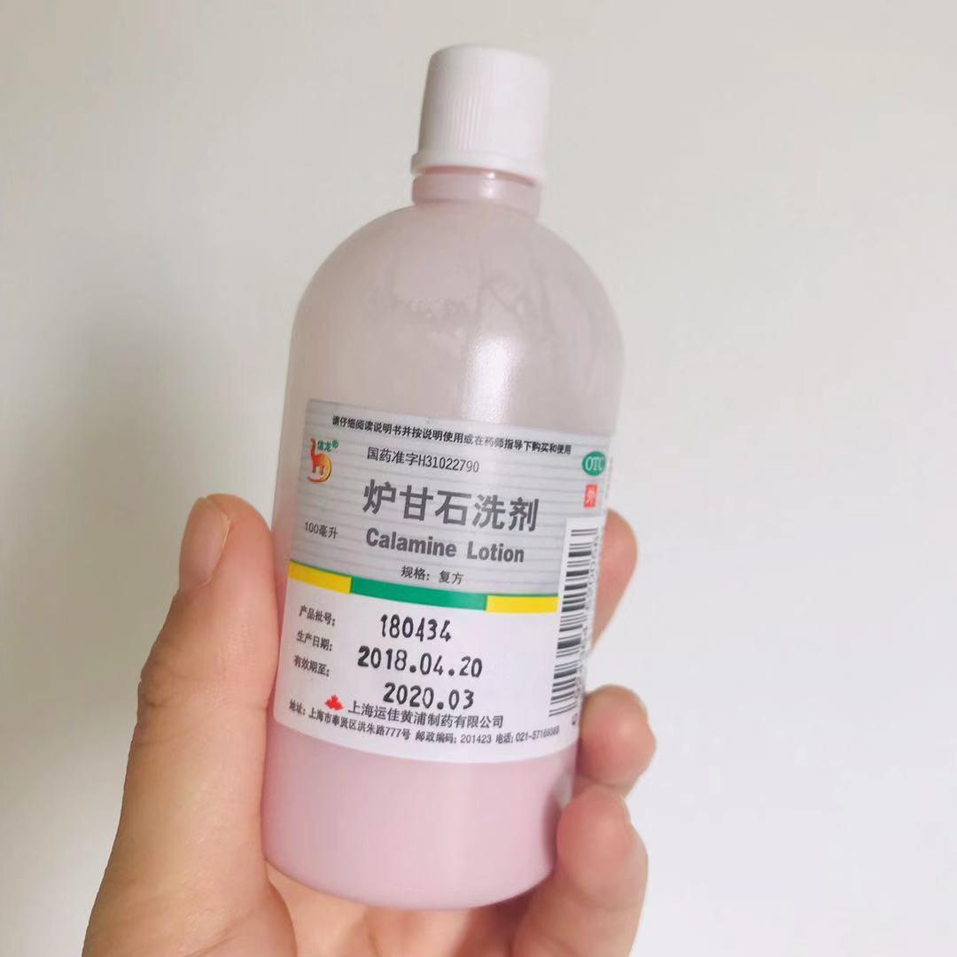 婴儿湿疹好了妈妈还用忌口吗,宝宝过敏湿疹中医的治疗方法