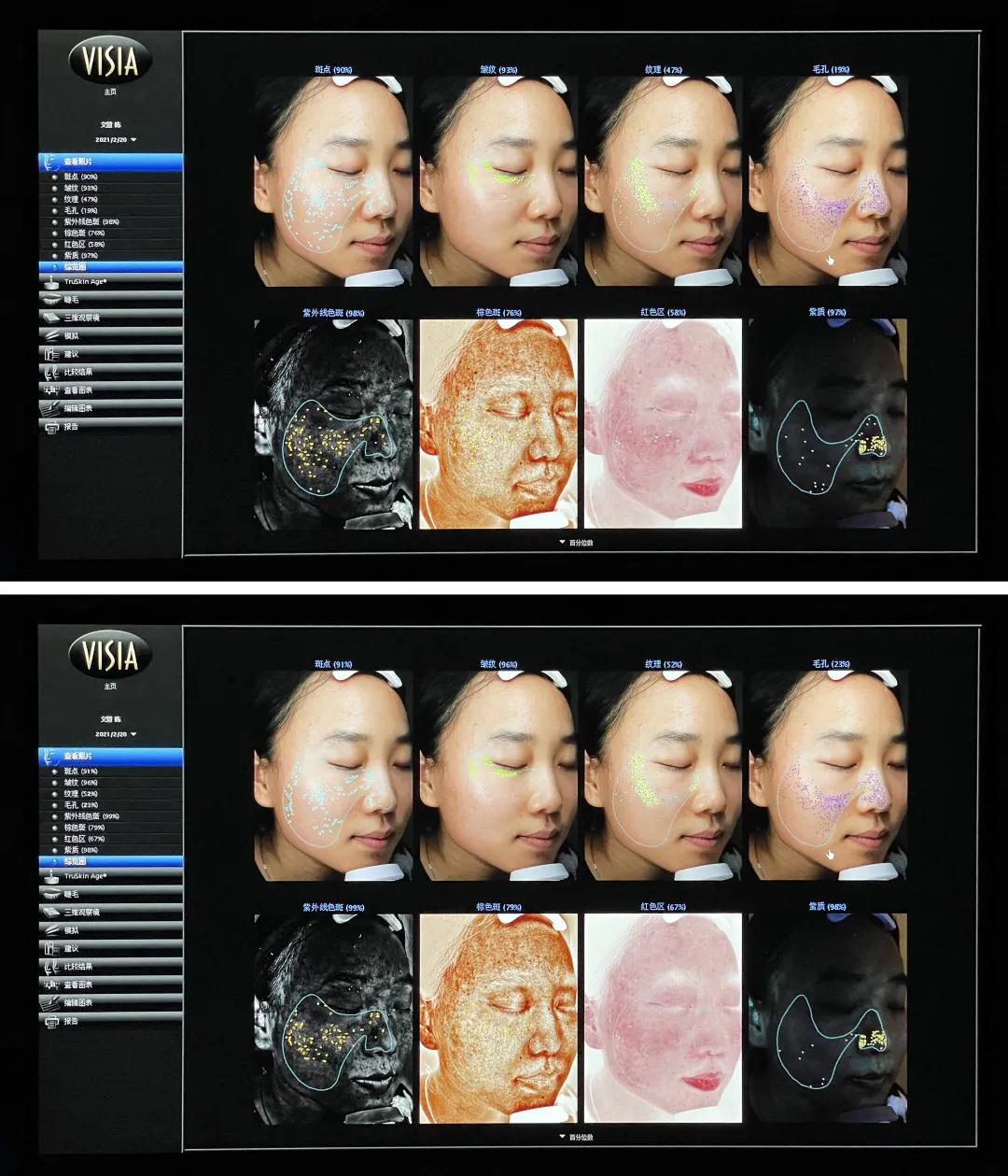 碧欧泉美白祛皱,碧欧泉美白抗老