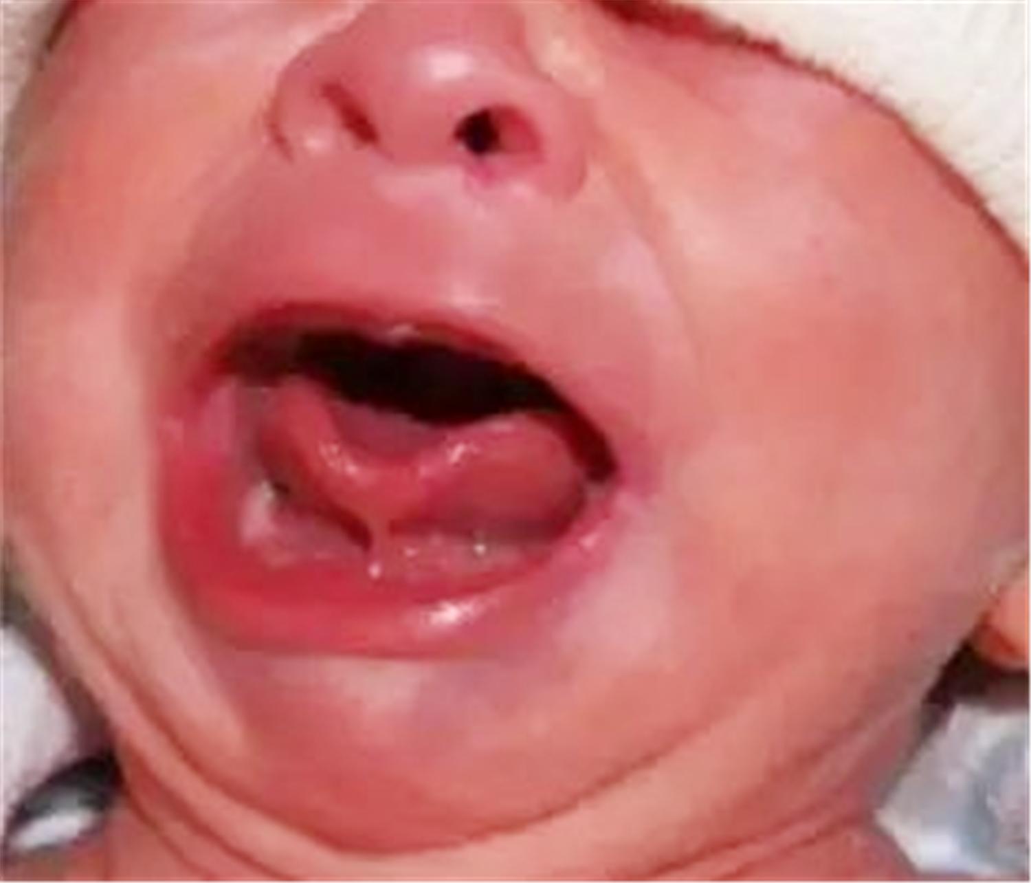 老人给孩子剪舌根的危害,老一辈对孙子的执念