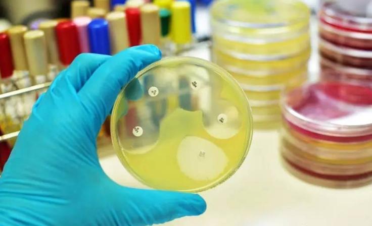 药敏是查什么的,药敏报告是怎么检查