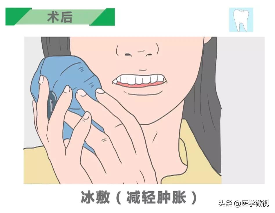 全瓷种植牙的牙基也是全瓷粉吗,种植牙全瓷和烤瓷有什么区别