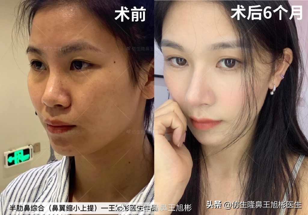 被鼻子封印的颜值,那些被鼻子封印的颜值