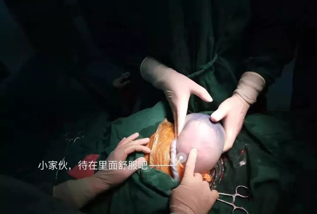 36岁孕妇产下一“透明蛋”,里面的宝宝居然还在动
