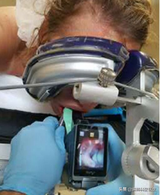 Airtraq氧瞬得，气管插管的最佳解决方案！