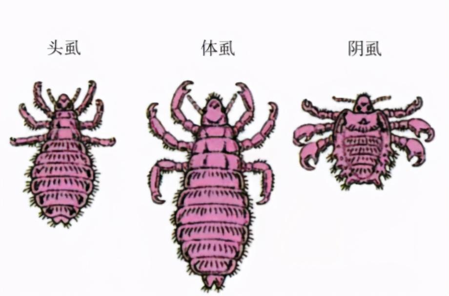 虱子和阴虱样子一样吗,阴虱头虱体虱能用一样的药吗