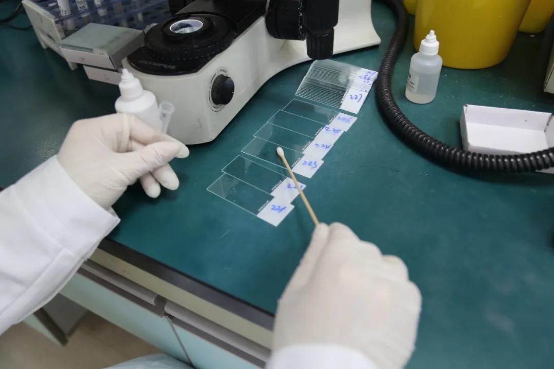 妇幼保健院查白带流程,妇幼检查白带