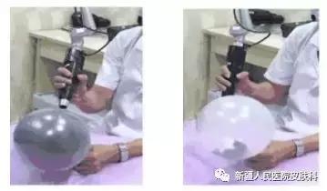 激光祛斑皮肤会变薄吗,燃料激光做了以后皮肤会变薄嘛