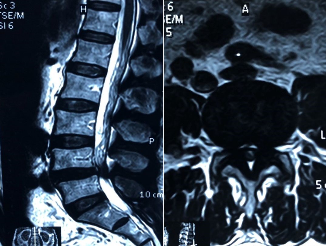 医林正骨健康操,老中医正骨颈肩腰腿疼痛
