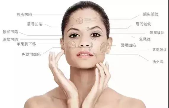 童颜针和脂肪填充哪个靠谱,童颜针和肉毒要间隔多久打