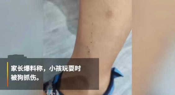 孩子被狗狗吓到了怎么处理,宝宝被自家狗狗咬破皮了但没出血