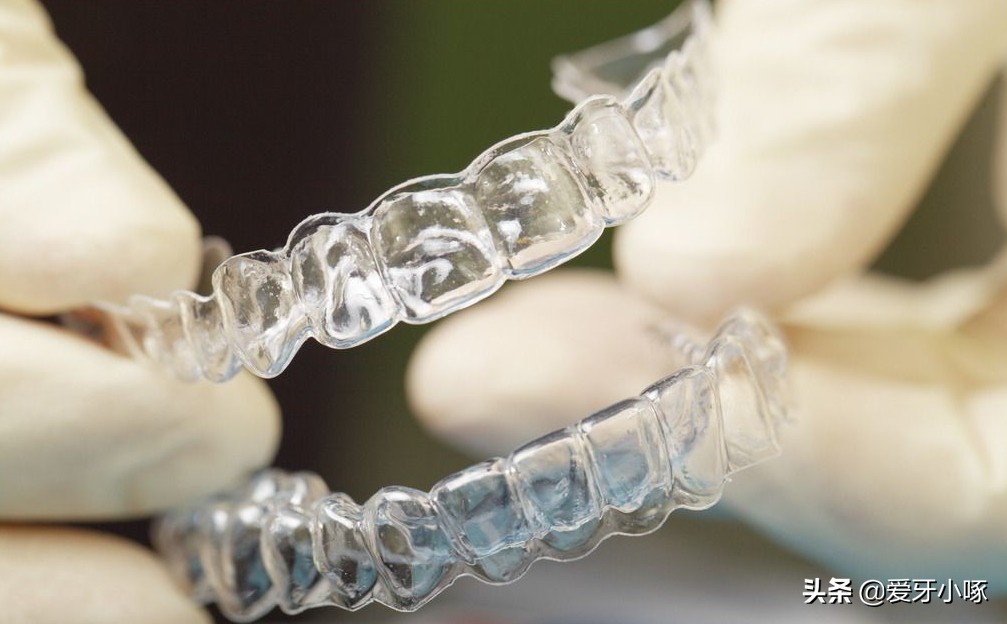 牙齿问题困扰和误区,不容忽视的牙齿问题