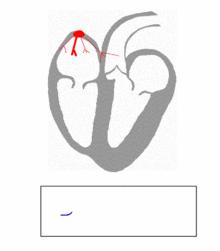 抗凝风险有哪些,抗凝治疗是针对心脏病的吗