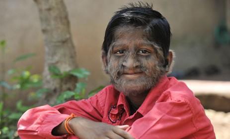 胡子体毛比较旺盛头发却稀疏,女性体毛稀疏是什么原因