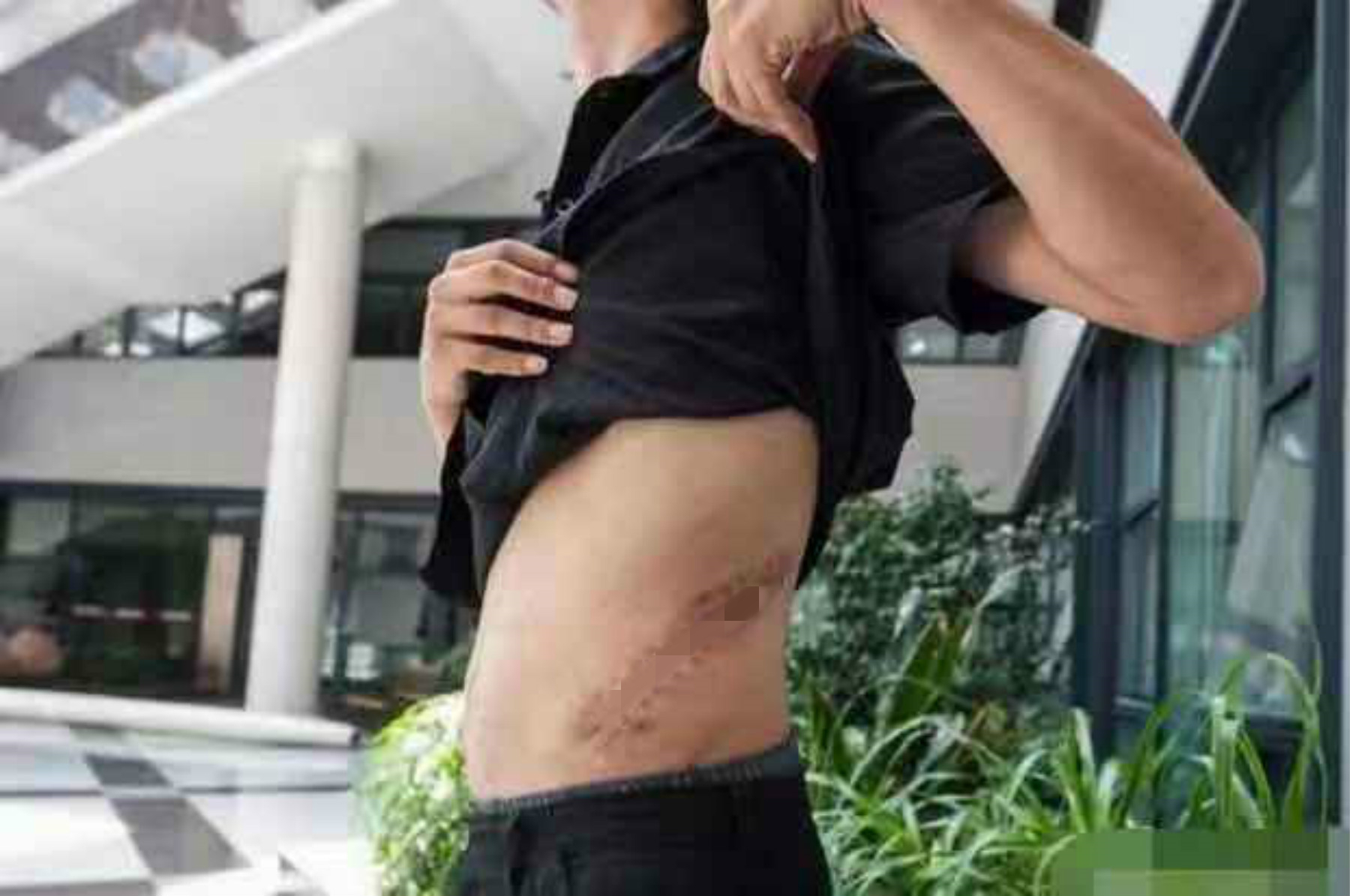 为了苹果手机卖肾的男孩,为了手机卖肾的小孩怎么样了