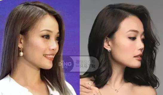 颅顶太低如何自救,颅顶低怎么自救